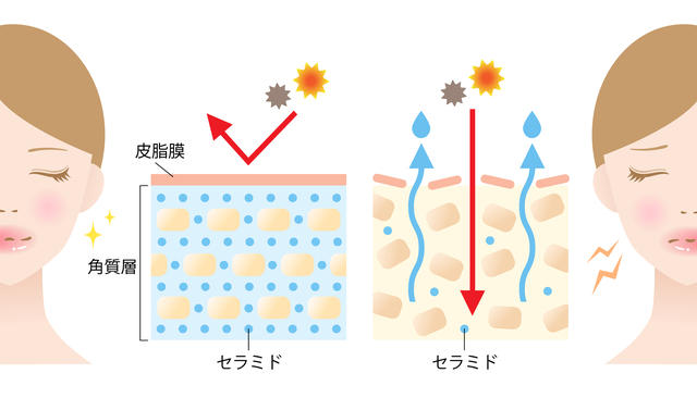 セラミド